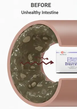 Diagram of an unhealthy intestine before cleansing, showing mucoid plaque and stagnant waste adhering to the colon walls, causing slow digestion