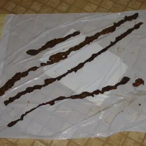 Testimonial photo showing long, rubbery mucoid strands and compacted waste released by Barbara B after the cleanse, totaling 172 inches, confirming deep colon cleansing